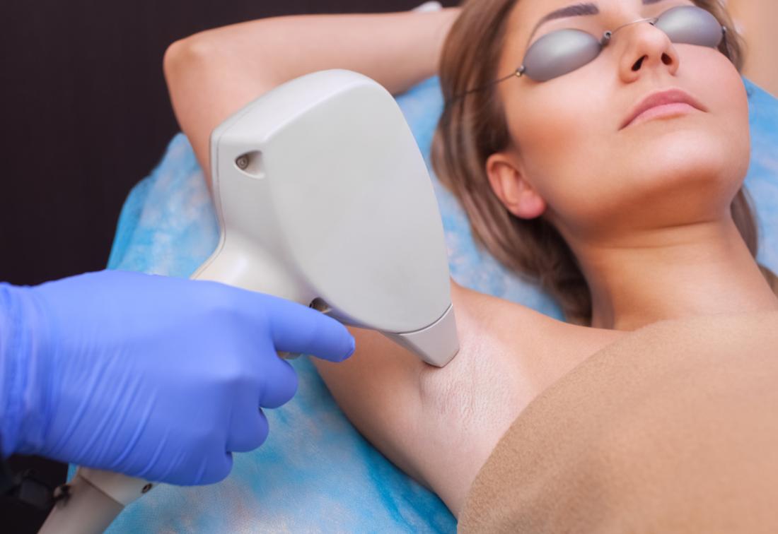 Permanent Laser Hair Removal Treatment in Hyderabad Cost
